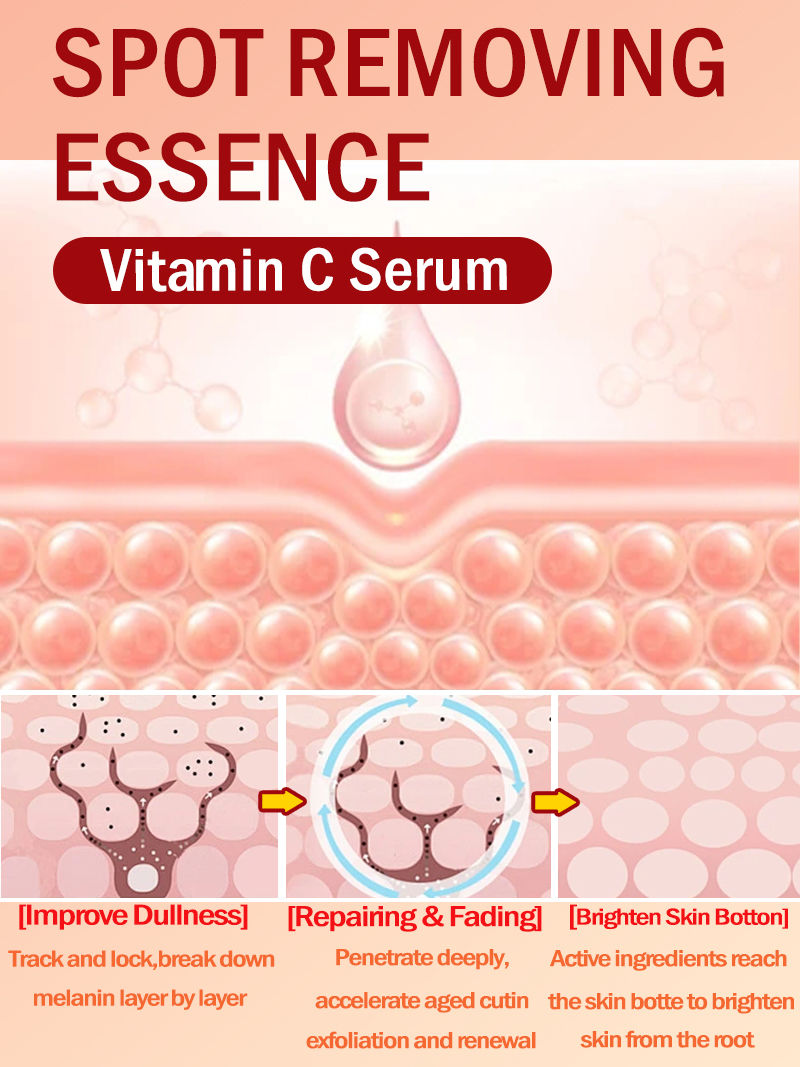 Lighten Freckles Melasma, Faci - огляд і ціна Luxury Skincare Essence